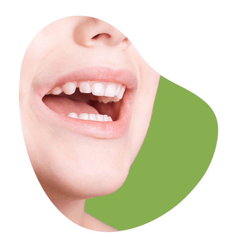 Big Smile With Baby Teeth Big Smile With Baby Teeth